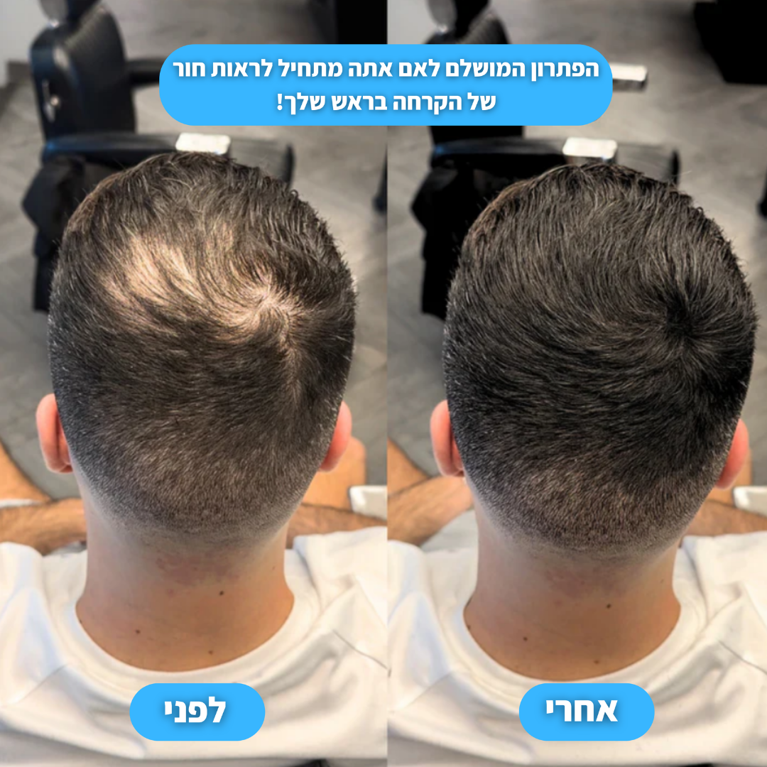 אבקת ההתקרחות של בורולקס