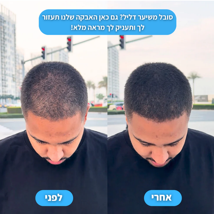 אבקת ההתקרחות של בורולקס